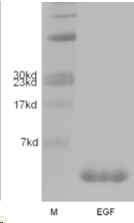 rh_EGF_his-1.jpg